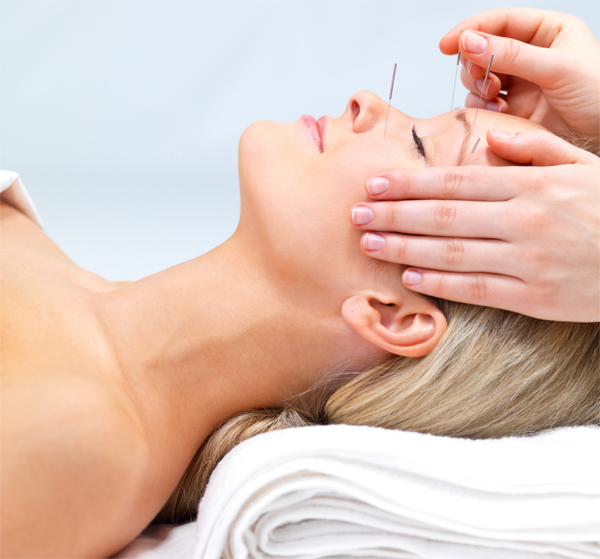 Beautiful young woman lying down receiving acupuncture therapy